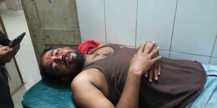 দূর্গাপুরে সাংবাদিকের উপর  বিএনপি কর্মীদের হামলা