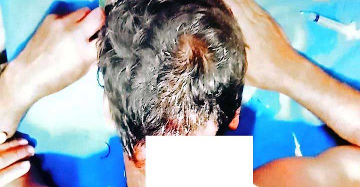 নেত্রকোনা কচুডুয়ারী তিন জনকে কুপিয়ে ও পিটিয়ে আহত