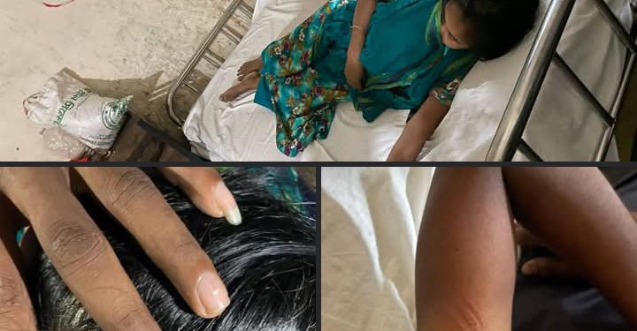 ভোলার দৌলতখানে তুচ্ছ ঘটনাকে কেন্দ্র করে সন্ত্রাসী হামলা